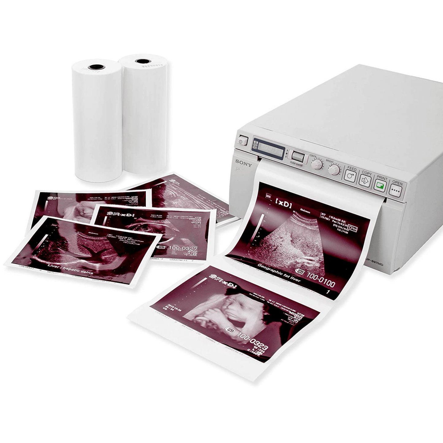 Carta Termica 10 Rotoli ORIGINALE SONY UPP-110 HG